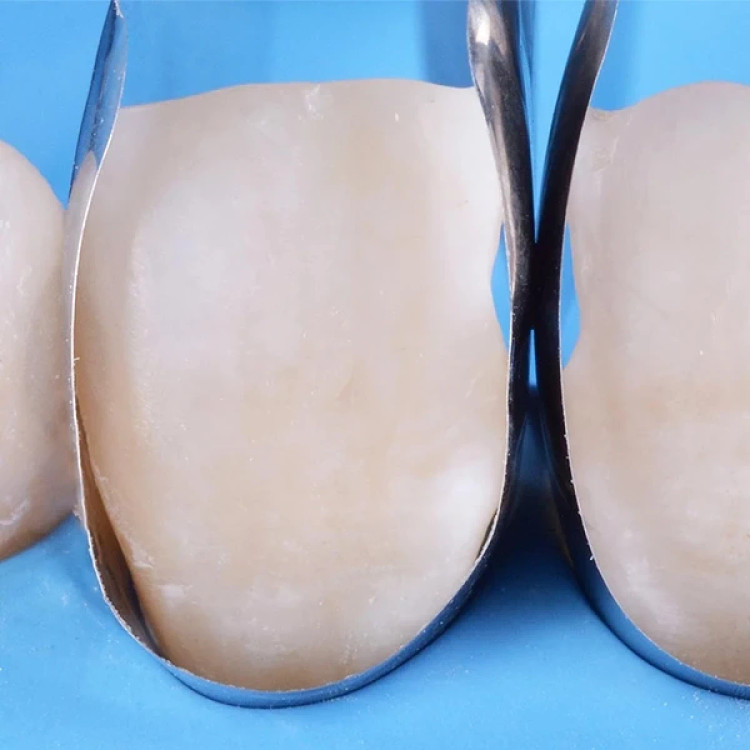 ماتریکس سکشنال قدامی 12 عددی DDS Dent