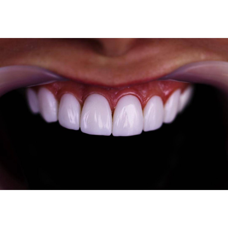 HEYTEC-BLEACH Direct Veneer Composite